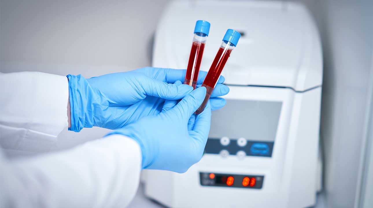 analyse sanguine sur la biochimie