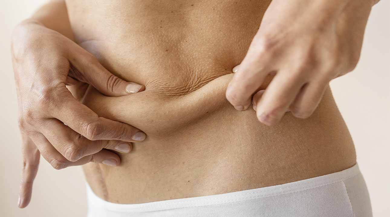 Comment retendre la peau du ventre après perte de poids